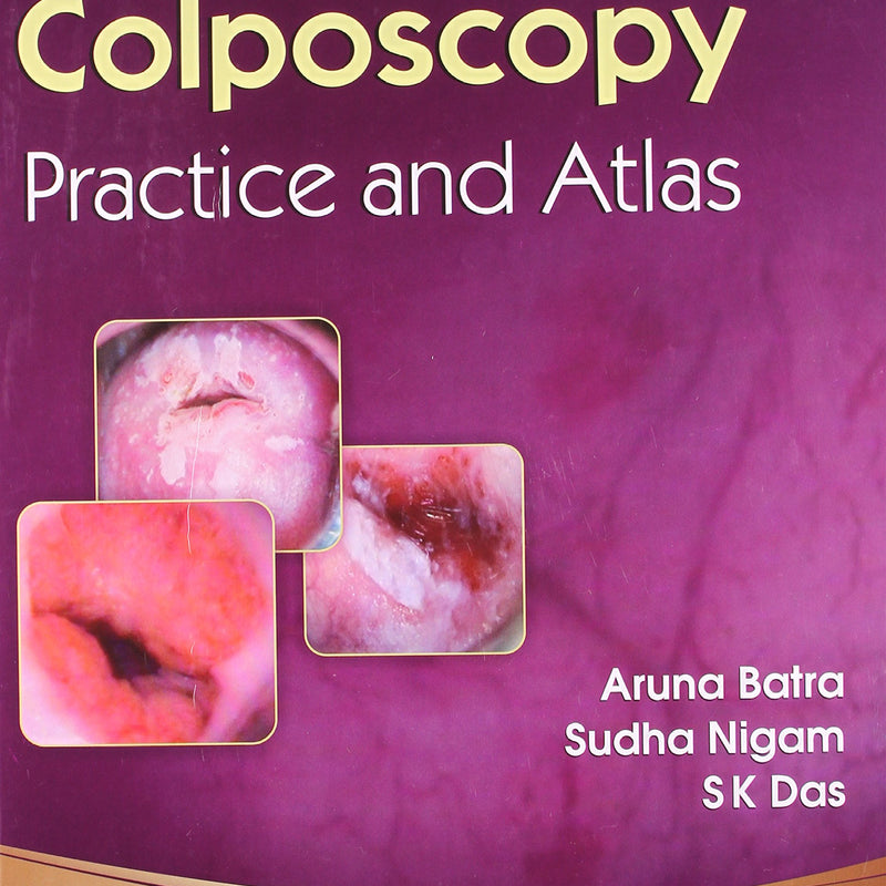 Colposcopy Practice And Atlas (Hb 2014) , by Aruna Batra