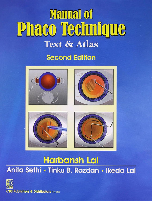 Manual Of Phaco Technique Text And Atlas 2Ed (Hb 2021) , by Harbansh Lal