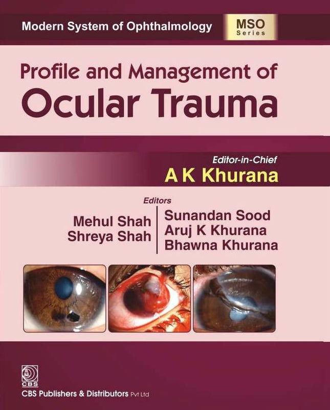 Profile And Management Of Ocular Trauma (Mso Series) 2016 (Hb 2024), by Aruj K Khurana