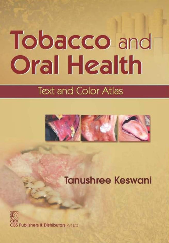Tobacco And Oral Health Text And Color Atlas (Pb 2016) , by Tanushree Keswani