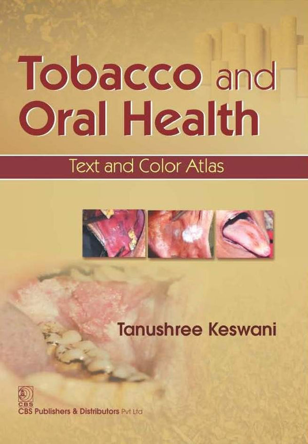 Tobacco And Oral Health Text And Color Atlas (Pb 2016) , by Tanushree Keswani