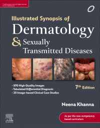 Illustrated Synopsis of Dermatology & Sexually Transmitted Diseases, Neena Khanna