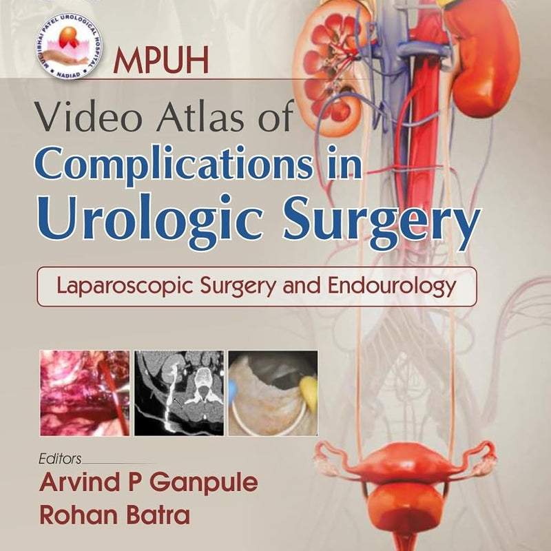 Mpuh Video Atlas Of Complications In Urologic Surgery Laparoscopic Surgery And Endourology Vol 1 Chapters 1 To 50 (Hb 2026), by Arvind P Ganpule