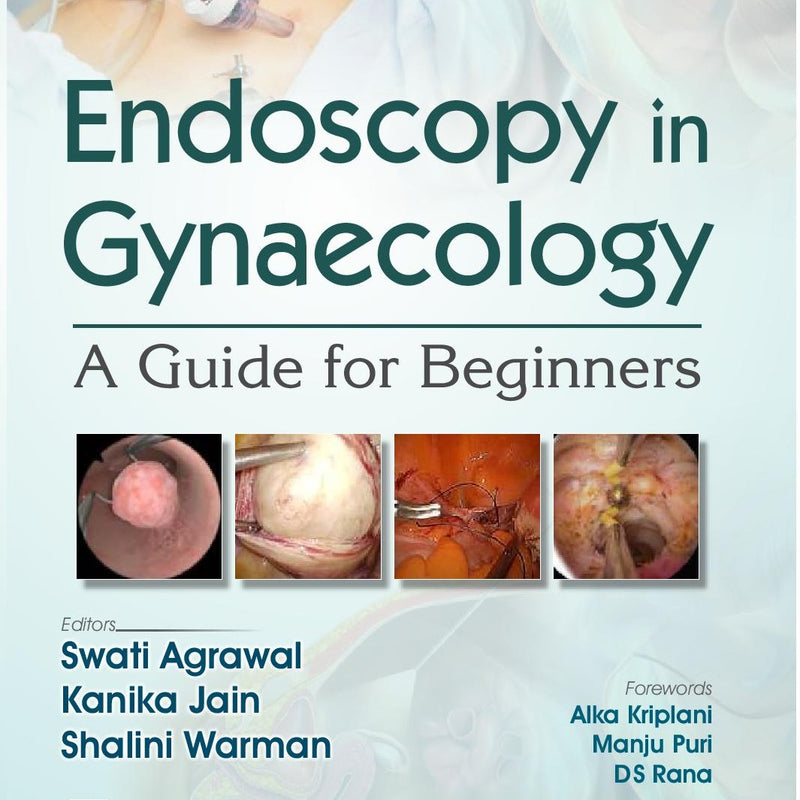 Endoscopy In Gynaecology A Guide For Beginners (Pb 2025), by Swati Agrawal