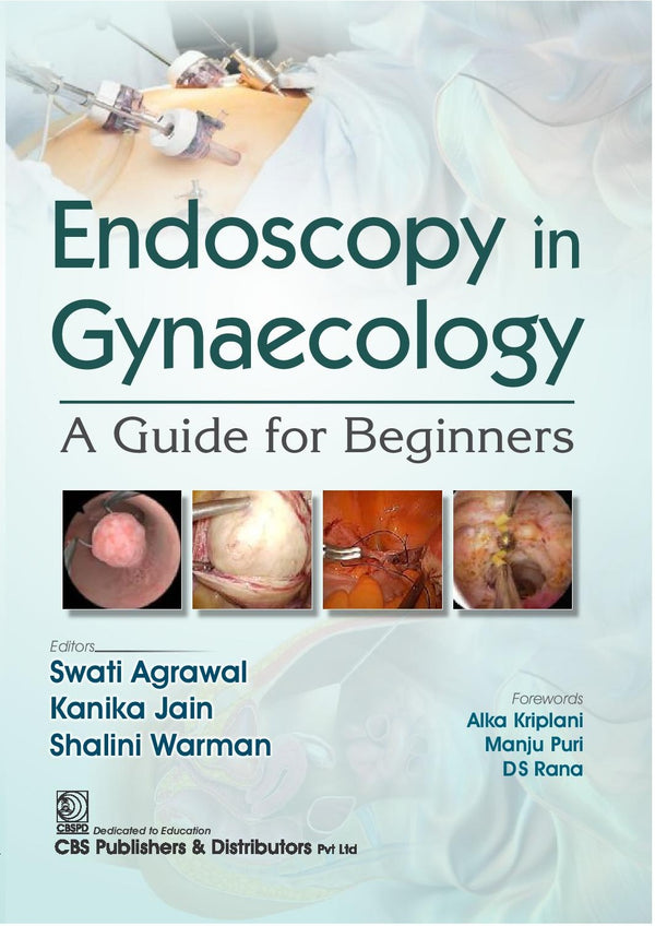 Endoscopy In Gynaecology A Guide For Beginners (Pb 2025), by Swati Agrawal