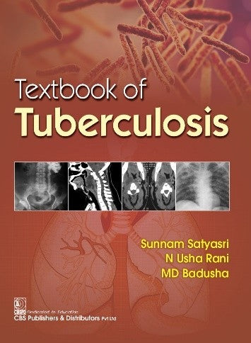 Textbook Of Tuberculosis (Pb 2023), by Sunnam Satyasri