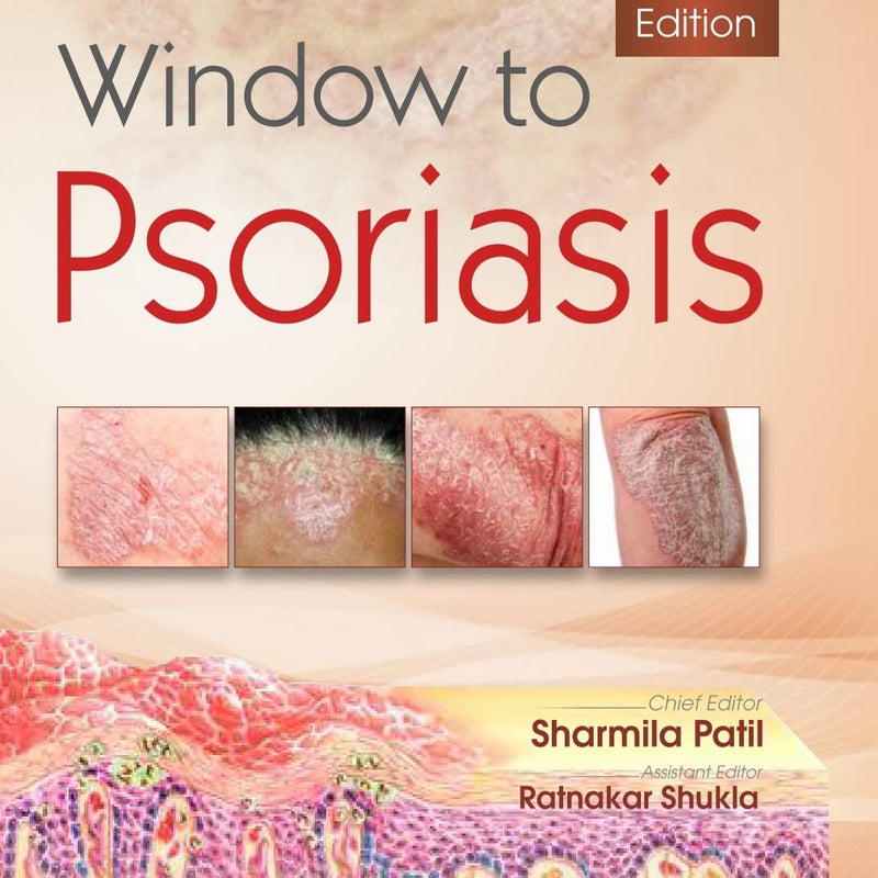 Window To Psoriasis 2Ed (Hb 2022), by Sharmila Patil