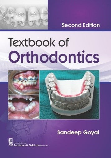 Textbook Of Orthodontics 2Ed (Pb 2022), by Sandeep Goyal