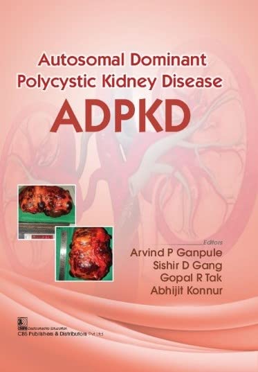 Autosomal Dominant Polycystic Kidney Disease Adpkd (Flexibond 2022)  , by Arvind P Ganpule