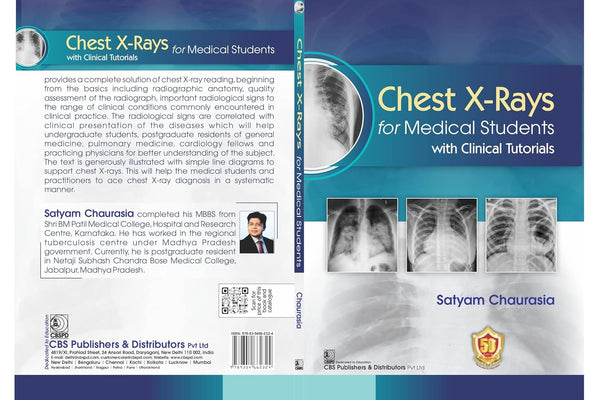 Chest X Rays For Medical Students With Clinical Tutorials (Pb 2026), by Satyam Chaurasia