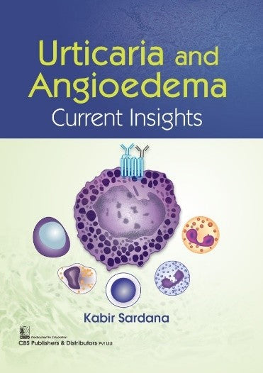 Urticaria And Angioedema Current Insights (Pb 2022), by Kabir Sardana