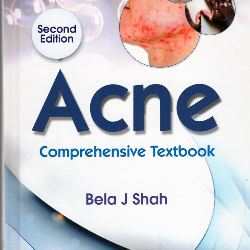 Acne Atlas With Treatment Options 2Ed (Hb 2025), by Bela J Shah