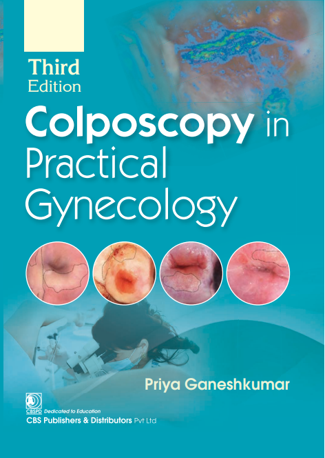 Colposcopy In Practical Gynecology 3Ed (Pb 2025), by Priya Ganesh Kumar