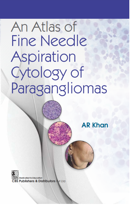 An Atlas Of Fine Needle Aspiration Cytology And Paraganglimas (Hb 2024), by Ar Khan