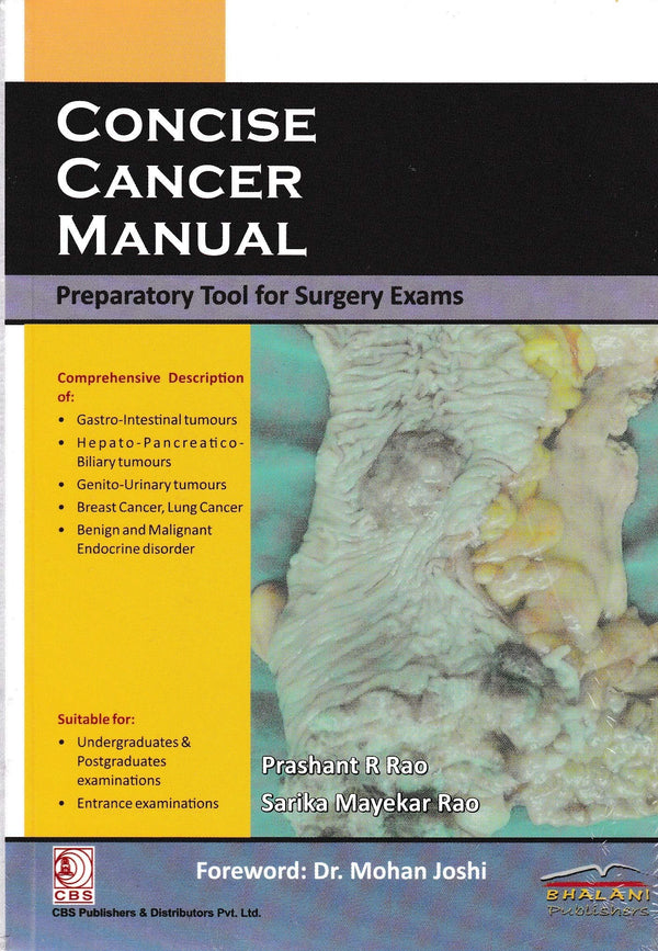 Concise Cancer Manual Preparatory Tool For Surgery Exams (Pb 2018) , by Dr Mohan Joshi