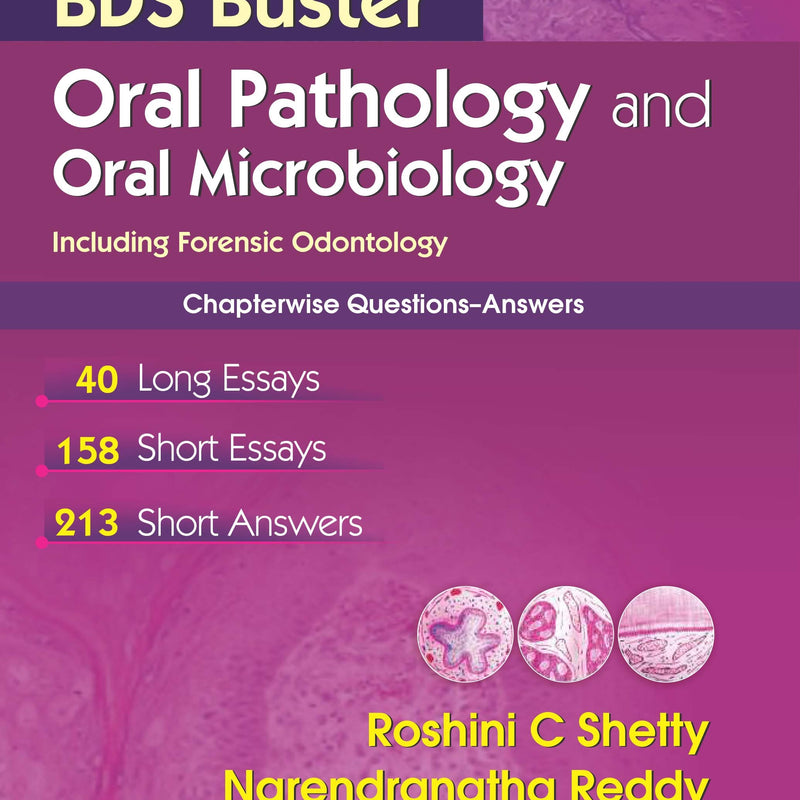 Bds Buster Oral Pathology And Oral Microbiology(Including Forensic Odontology 3Rd Bds (Pb 2016), by Roshini C Shetty