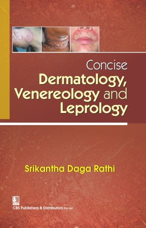 Concise Dermatology Venereology And Leprology (Pb 2017) , by Srikantha Daga Rathi