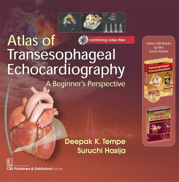 Atals Of Transesophageal Echocardiography A Beginners Perspective (Included Cd Containing Video Files)  (Hb 2017) , by Deepak K Tempe