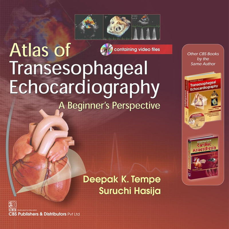 Atals Of Transesophageal Echocardiography A Beginners Perspective (Included Cd Containing Video Files)  (Hb 2017) , by Deepak K Tempe
