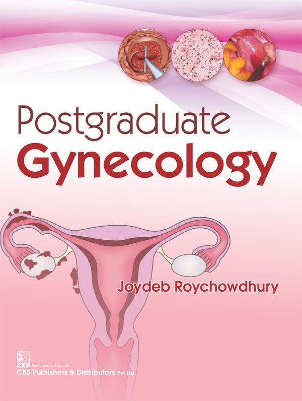 Postgraduate Gynecology (Pb 2017) , by Joydeb Roychoudhuri