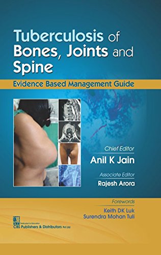 Tuberculosis Of Bones Joints And Spine (Hb 2017) , by Anil K Jain