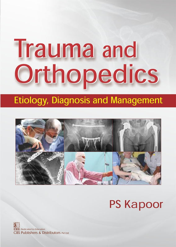 Trauma And Orthopedics Etiology Diagnosis And Management (Pb 2017) , by P S Kapoor