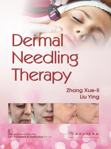 Dermal Needling Therapy (Pb 2019) , by Zhang Xue Li