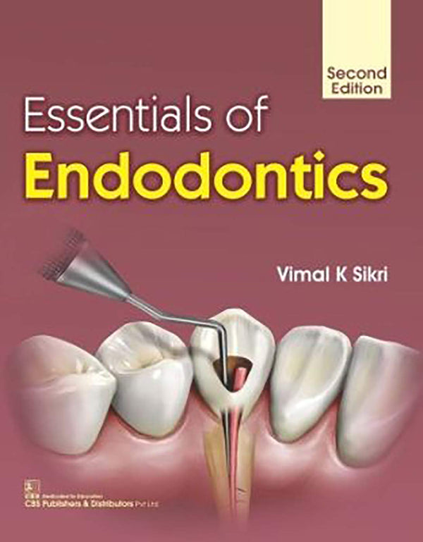 Essentials Of Endodontics 2Ed (Pb 2019) , by Vimal K Sikri