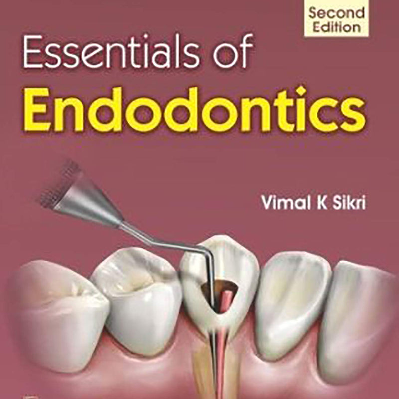 Essentials Of Endodontics 2Ed (Pb 2019) , by Vimal K Sikri