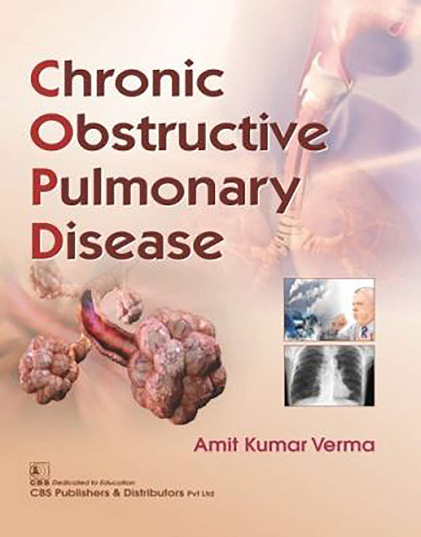 Chronic Obstructive Pulmonary Disease (Pb 2019) , by Amit Kumar Verma