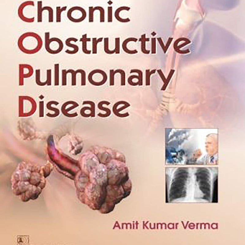Chronic Obstructive Pulmonary Disease (Pb 2019) , by Amit Kumar Verma