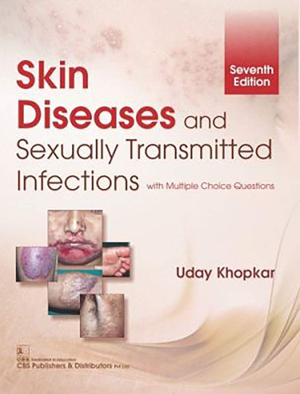 Skin Diseases And Sexually Transmitted Infections 7Ed (Pb 2024) , by Uday Khopkar