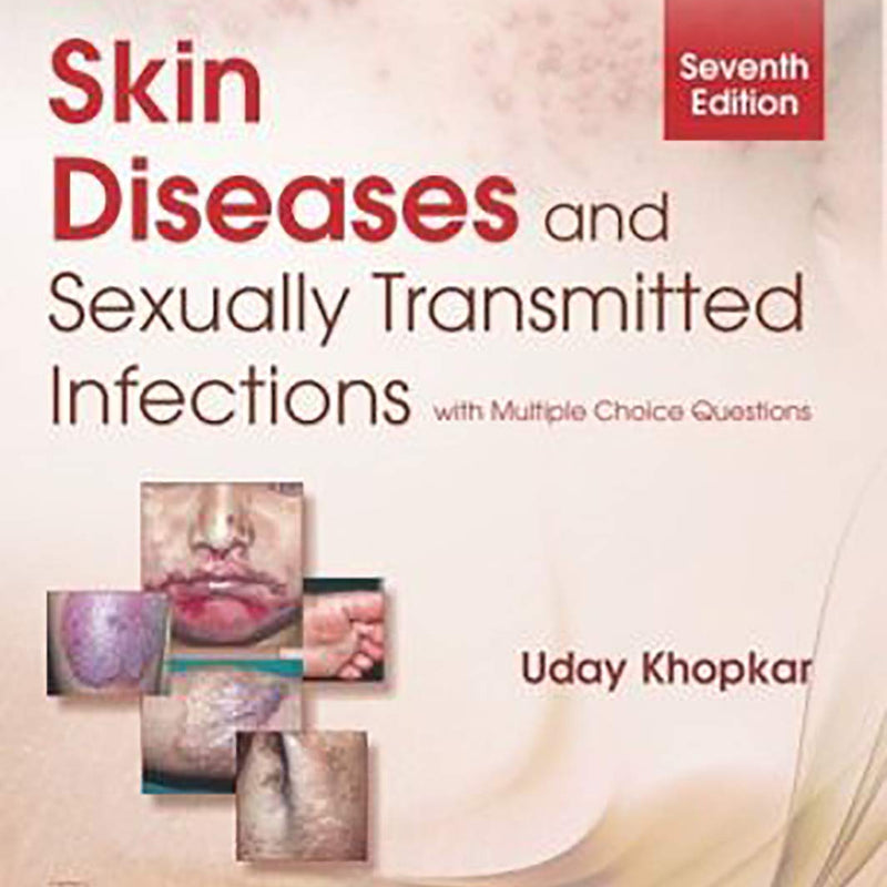 Skin Diseases And Sexually Transmitted Infections 7Ed (Pb 2024) , by Uday Khopkar