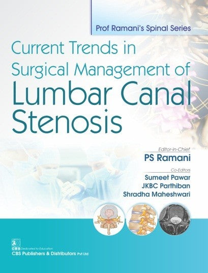 Current Trends In Surgical Management Of Lumbar Canal Stenosis (Pb 2019) , by P S Ramani