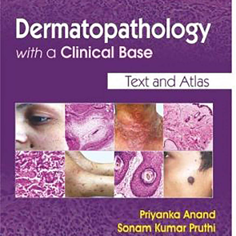 Dermatopathology With A Clinical Base (Pb 2019) , by Priyanka Anand