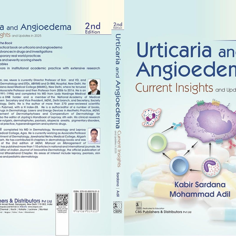 Urticaria And Angioedema Current Insights And Updates In 2025 2Ed (Hb 2026), by Kabir Sardana