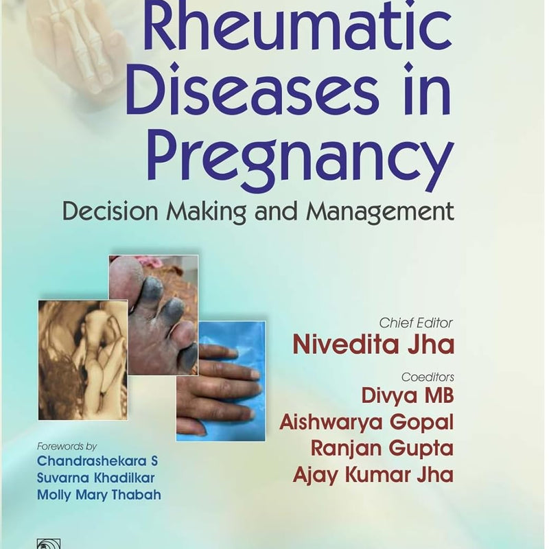 Rheumatic Diseases In Pregnancy Decision Making And Management (Hb 2026), by Nivedita Jha