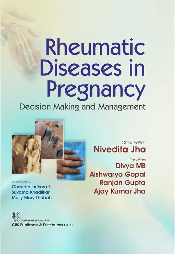 Rheumatic Diseases In Pregnancy Decision Making And Management (Hb 2026), by Nivedita Jha