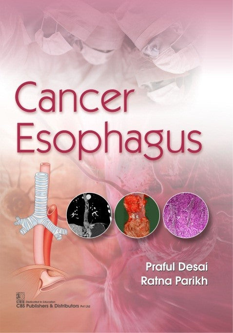 Cancer Esophagus (Pb 2020) , by Praful Desai