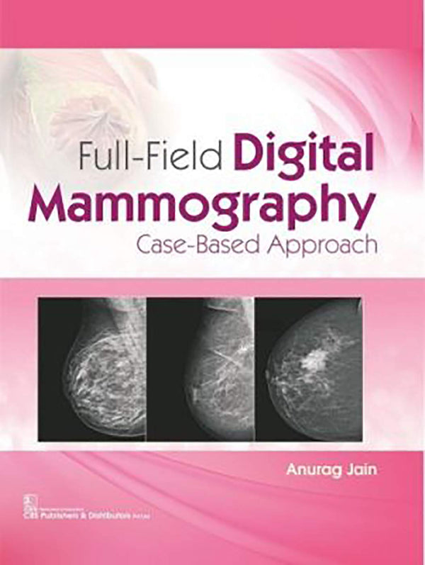 Full Field Digital Mammography Case Based Approach (Hb 2020) , by Anurag Jain