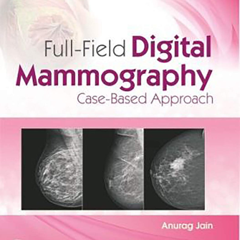 Full Field Digital Mammography Case Based Approach (Hb 2020) , by Anurag Jain