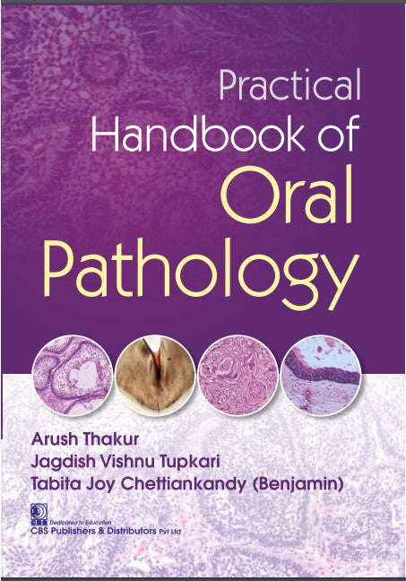 Practical Handbook Of Oral Pathology (Pb 2021), by Arush Thakur