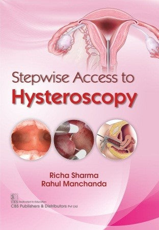 Stepwise Access To Hysteroscopy (Hb 2020) , by Richa Sharma