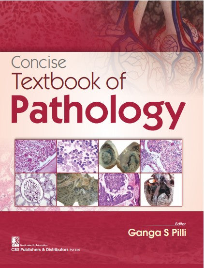 Concise Textbook Of Pathology (Pb 2024), by Ganga S Pilli