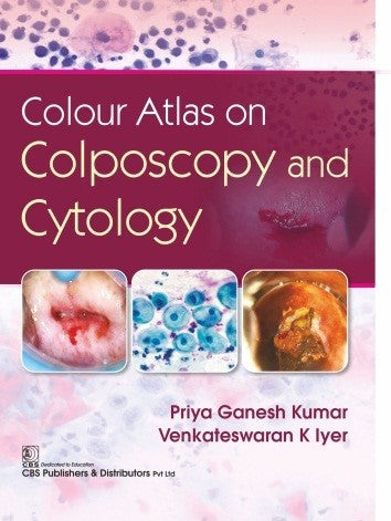 Colour Atlas On Colposcopy And Cytology (Hb 2020), by Priya Ganesh Kumar