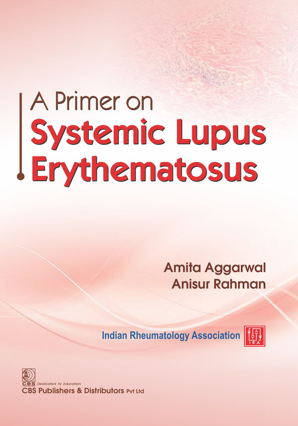 A Primer On Systemic Lupus Erythematosus (Pb 2021), by Amita Aggarwal