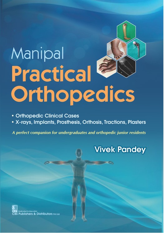 Manipal Practical Orthopedics (Pb 2020), by Vivek Pandey