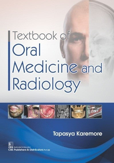 Textbook Of Oral Medicine And Radiology (Pb 2021), by Tapasya Vaibhav Karemore