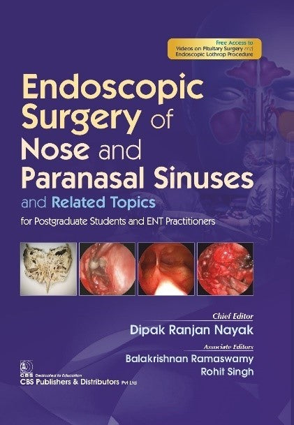 Endoscopic Surgery Of Nose And Paranasal Sinuses And Related Topics (Hb 2022), by Dipak Ranjan Nayak