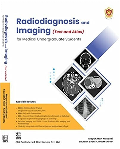 Radiodiagnosis And Imaging (Text And Atlas) For Medical Undergraduate Students (Pb 2023), by Mayur Arun Kulkarni
